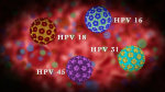 hpv-3537-1415677963.jpg