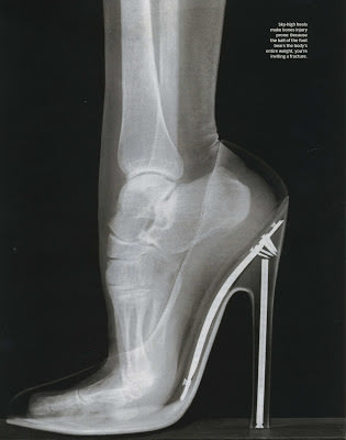 ΣΟΚ!!! Δείτε μια ακτινογραφία σε γυναικείο πόδι με γόβα...