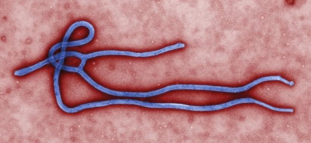 Particules virales d'Ebola observées au microscope électronique. Un patient britannique contaminé en Sierra Leone par le virus Ebola est sorti de l'hôpital de Londres où il était soigné depuis dix jours à l'aide du traitement expérimental ZMapp. /Image diffusée le 1er août 2014/REUTERS/Cynthia Goldsmith/CDC