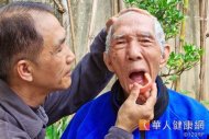 台灣進入高齡化，銀髮族飽受缺牙痛苦，造成營養攝取受到影響。