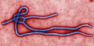 O Centro de Controle de Doenças de Atlanta, no estado americano da Geórgia, revelou a morfologia do vírus Ebola