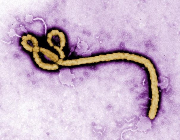 Particule virale d'Ebola observée au microscope électronique. Des chercheurs estiment à 75% le risque de voir le virus de la fièvre Ebola atteindre la France d'ici vingt jours, à 50% pour la Grande-Bretagne, mais les systèmes de santé et les conditions de vie ne devraient pas exposer ces pays à des flambées épidémiques comparables à ce qui se passe en Afrique de l'Ouest. /Image d'archives/REUTERS/Frederick Murphy/CDC