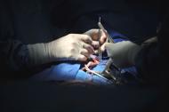 Cirurgia de coração aberto, realizada em 17 de dezembro de 2007, no Hospital Georges Pompidou, de Paris