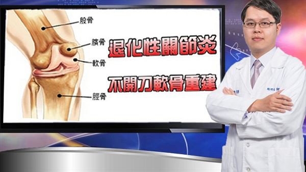 鄧翔駿醫師表示，複合增生療法不用開刀，可以達到「抑制軟骨退化，促進軟骨新陳代謝」的目標。（圖片提供／鄧翔駿醫師）