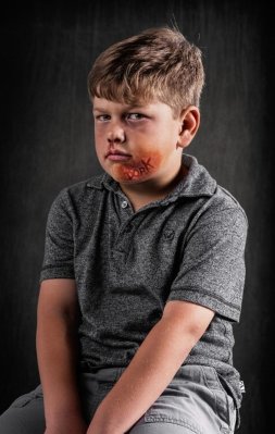 Συγκλονιστικό: Πώς αποτυπώνεται η λεκτική βία στην ψυχή των παιδιών