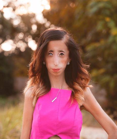 lizzie-velasquez-once-dubbed-world-s-ugliest-woman-shares-how-she