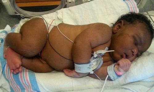 Oh, Baby: Woman Gets 14-Pound 'Surprise' — But How?