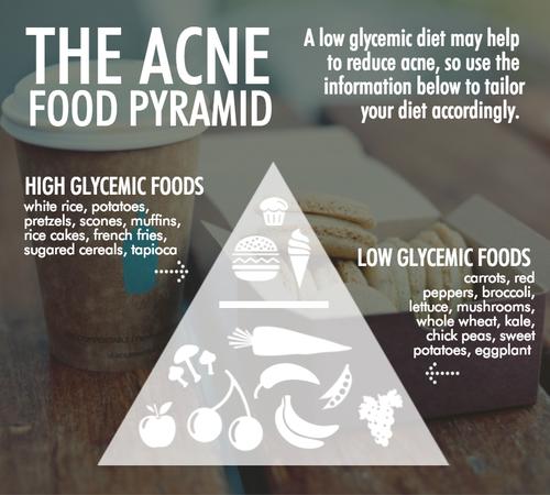 Acne Food Pyramid Reveals How To Eat For Clear Skin