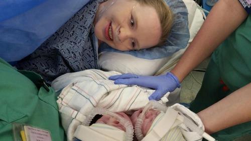 Rare Conjoined Twins Die at Hospital a Day After Birth