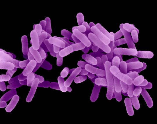 Legionnaire's Disease Bacteria Found at GlaxoSmithKline ...