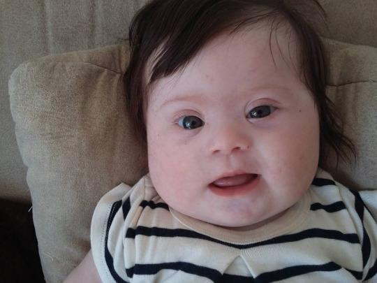 Mom s Emotional Facebook Post About Baby With Down Syndrome Goes Viral