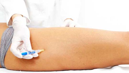 Sclerotherapy and Spider Veins in Charlotte, Vein Experts