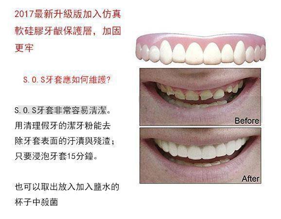 現貨可脫卸美容牙套仿真軟矽膠假牙牙套 美白貼片牙套 自拍神器/澤米【新品首發！僅5天狂售200萬件創造美國的銷售奇跡！】