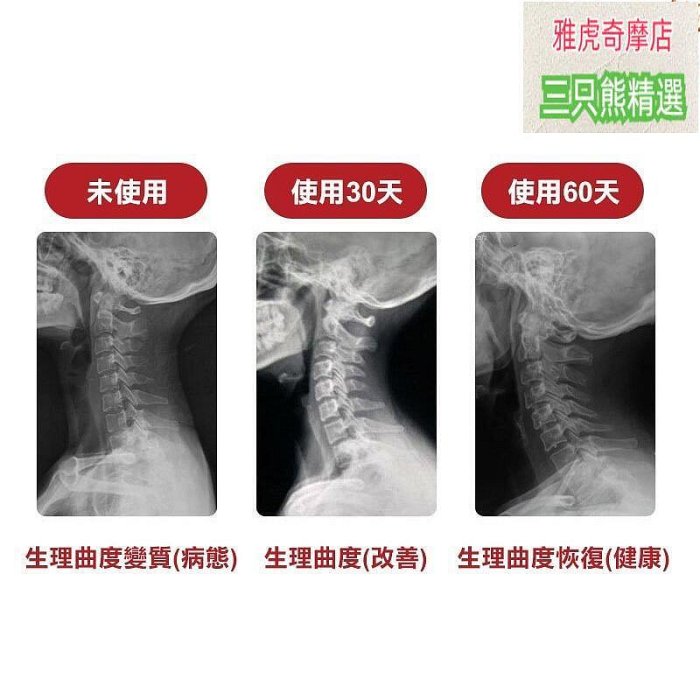 頸椎牽引器拉伸脖子 支撐固定頸託 護頸椎 頸椎 脖子僵硬舒緩 頸椎按摩器 頸椎護具 頸架鬆B24