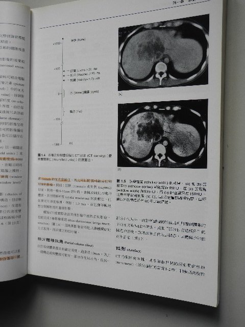 醫學影像診斷學│鄭慶明│合記│編號:RH