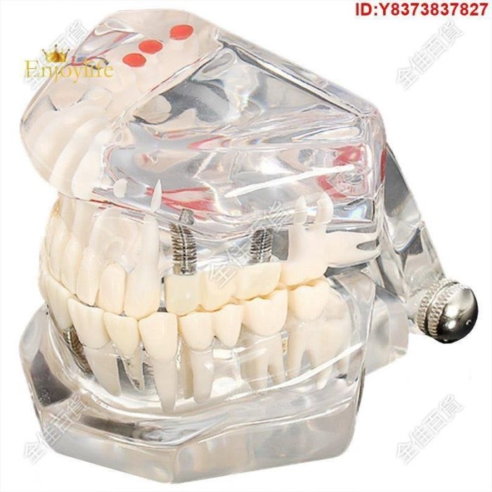 熱銷 [推薦]牙齒模型模型牙齒護理模型假牙牙醫牙科演示 K67-春天裡小小店