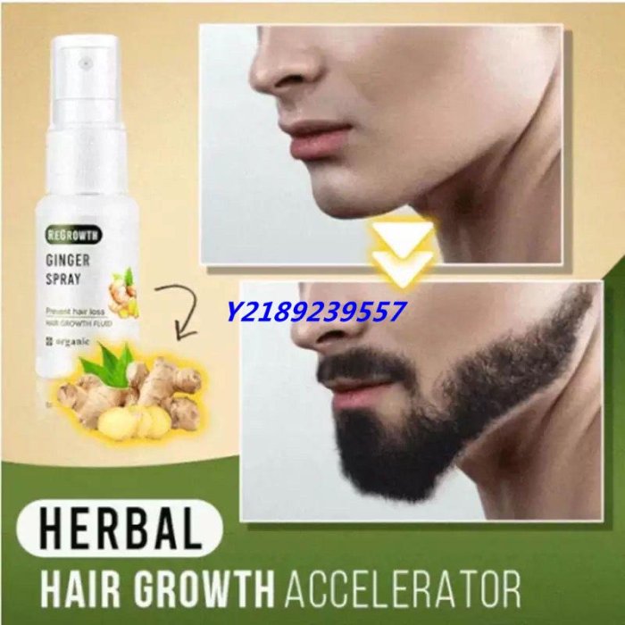 新店下殺折扣  Hair Growth Spray Ginger Essence Hair Growing Spray Fast Gro