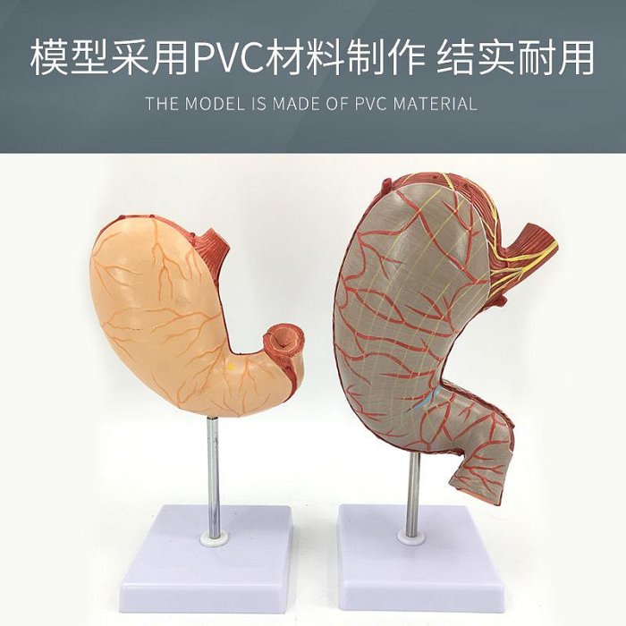 人體胃解剖模型 胃的病變模型 胃部疾病演示模型 病理胃 胃的穿孔