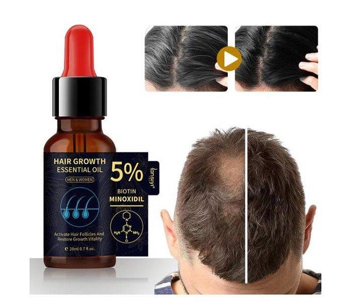 【萬家】買2送1 買5送3 生薑王頭髮營養液養育頭髮根防止脫落控油5%Minoxidil精華液 現貨