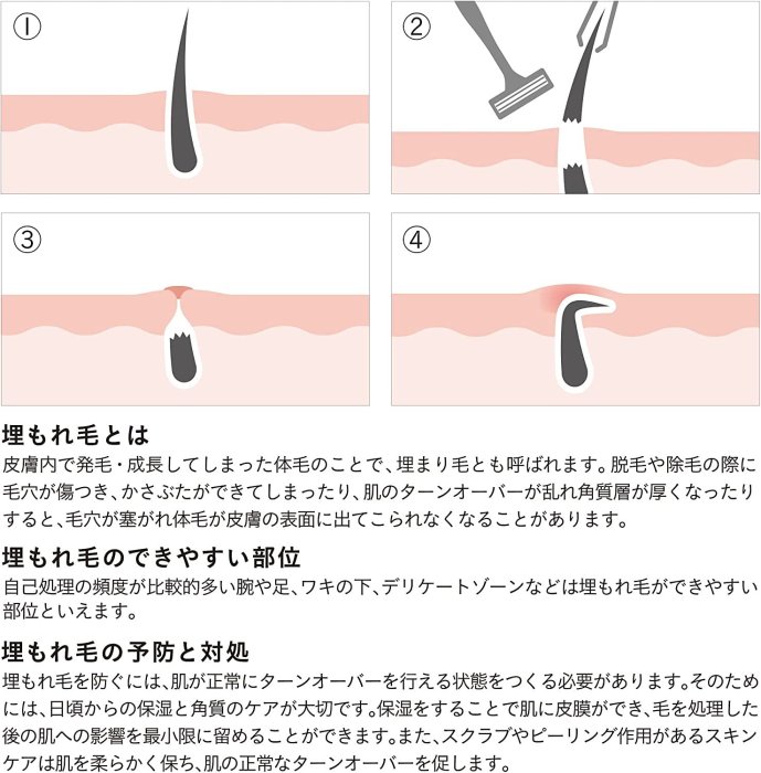 日本製 iroha 私密處保養 保濕 護理水 乳液 VIO專用 私密處 美容液 乾燥保濕 除毛後保養❤JP