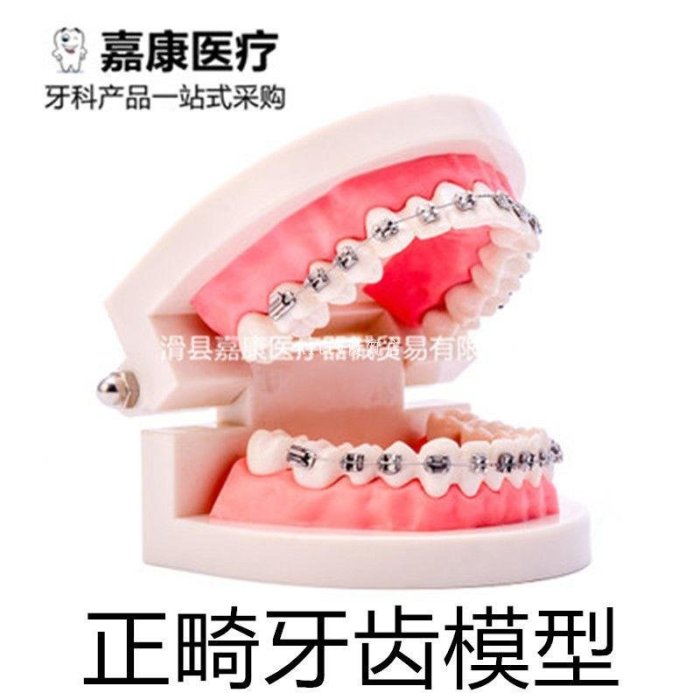 嘉康牙齒模型教學用口腔模型牙齒正畸模型帶托槽正畸齒科模型 促銷