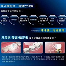 【KINYO】攜帶型健康沖牙機(IR-1001)