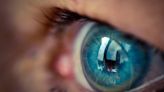 La Nación / Cambios en la retina puede indicar problemas renales, según estudio