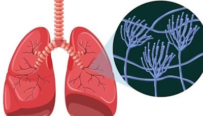 Breakthrough In Lung Cancer Treatment, Study Finds