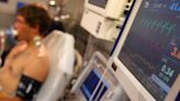 Irregular heartbeat likely to be one of the reasons more people than usual have been dying this year