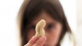 Should schools ban peanuts? What to know as Quebec group calls for end to allergen bans in school