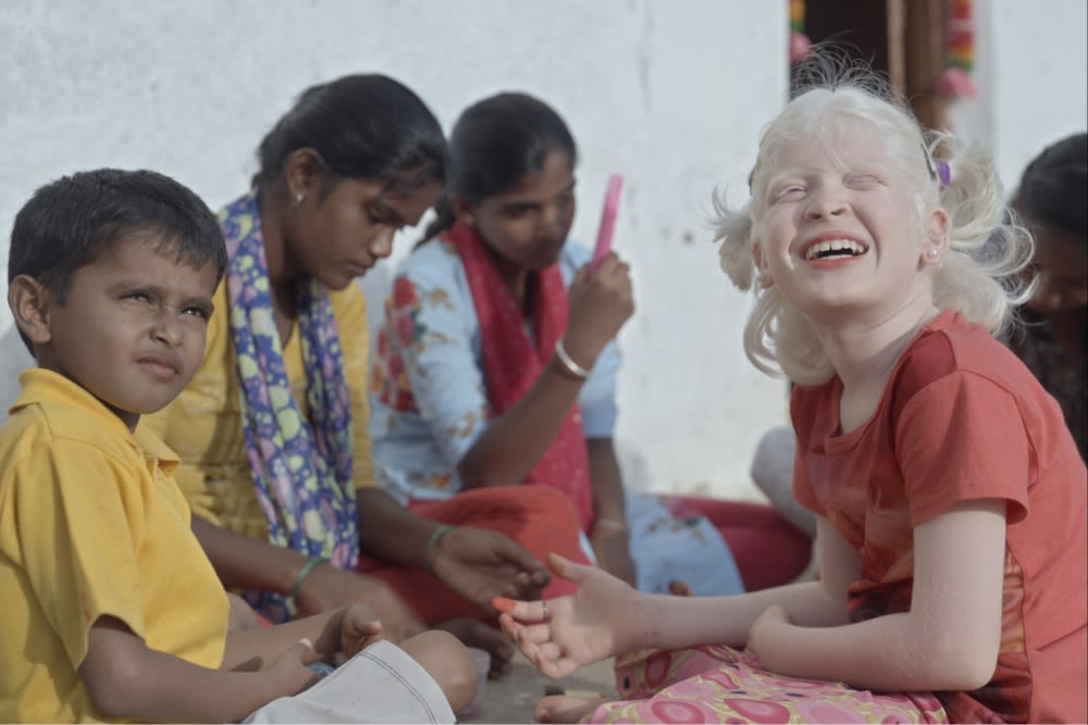 India’s Manohara Evolves From Award-Winning Child Actor to Director of Shanghai-Selected Film on Albinism ‘Bird of a Different Feather’