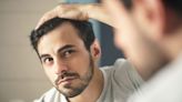 Can Metformin Cause Hair Loss?