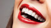 Blanqueamiento dental: ¿Es seguro usar bicarbonato de sodio?