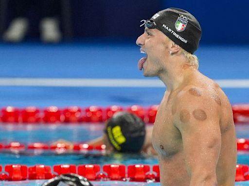 What are the red round marks on the skin of Olympic athletes?