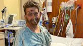Man Recovers After Rare Bacteria Caused Septic Shock, Left Him with 'No Brain Activity': 'We Never Lost Hope'