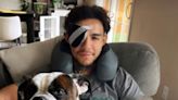 UFC fighter Andre Fili out of bout after emergency eye surgery