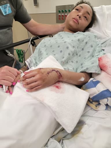 Oklahoma teen punches shark after being bitten while vacationing at Texas beach