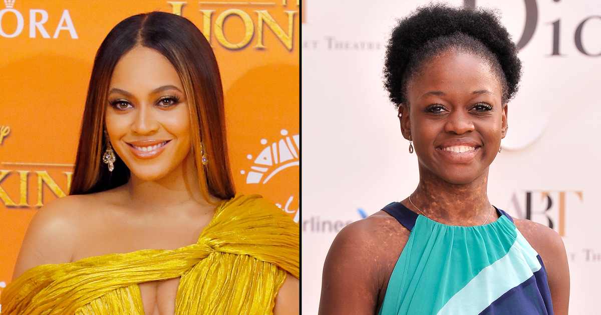 Beyonce Once Called Michaela DePrince a 'Creature From Another Planet'