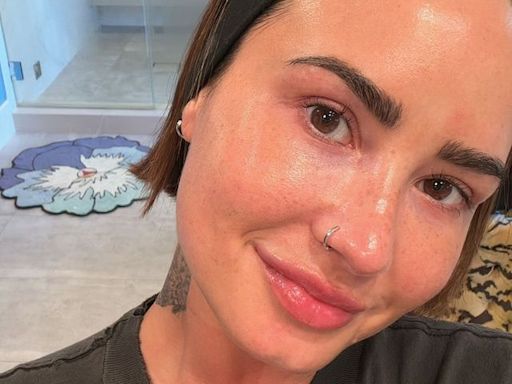 Demi Lovato posa sem maquiagem após tratamento estético: "Pele brilhando"