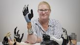 Un innovador brazo biónico que se fusiona con el esqueleto y los nervios del usuario podría mejorar la atención a los amputados