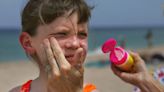 If Your Sunscreen Is Expired, You Could Still Get A Sunburn