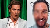 Matthew McConaughey fue picado por una abeja en la cara y su foto se hizo viral