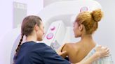 Why all women should have mammogram accountability partners