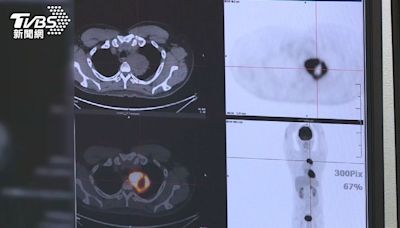 長期久咳 小心「這疾病」找上門 醫師：若輕忽，病況更嚴重！