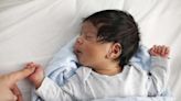 What to Know About Hemolytic Disease of the Newborn