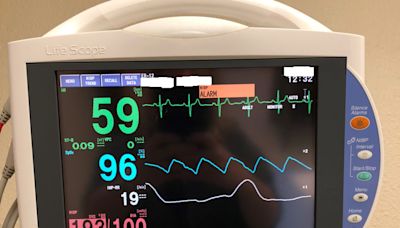 Adults with congenital heart disease faced higher risk of abnormal heart rhythms