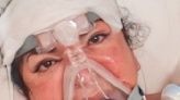 El calvario de Loli, mujer de 'el prestamista' de 'Los Gipsy Kings', tras someterse a una operación de estética en Turquía