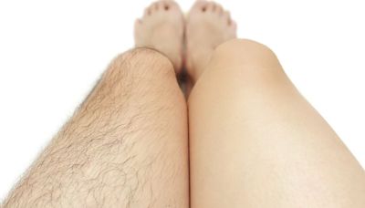 I'm a doctor, here's why you should never shave your body hair