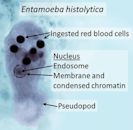 Entamoeba histolytica