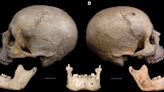Hallazgo de restos de una cirugía contra el cáncer de hace 4.000 años en Egipto